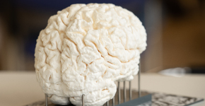 3D-Druck: weißes Gehirn
